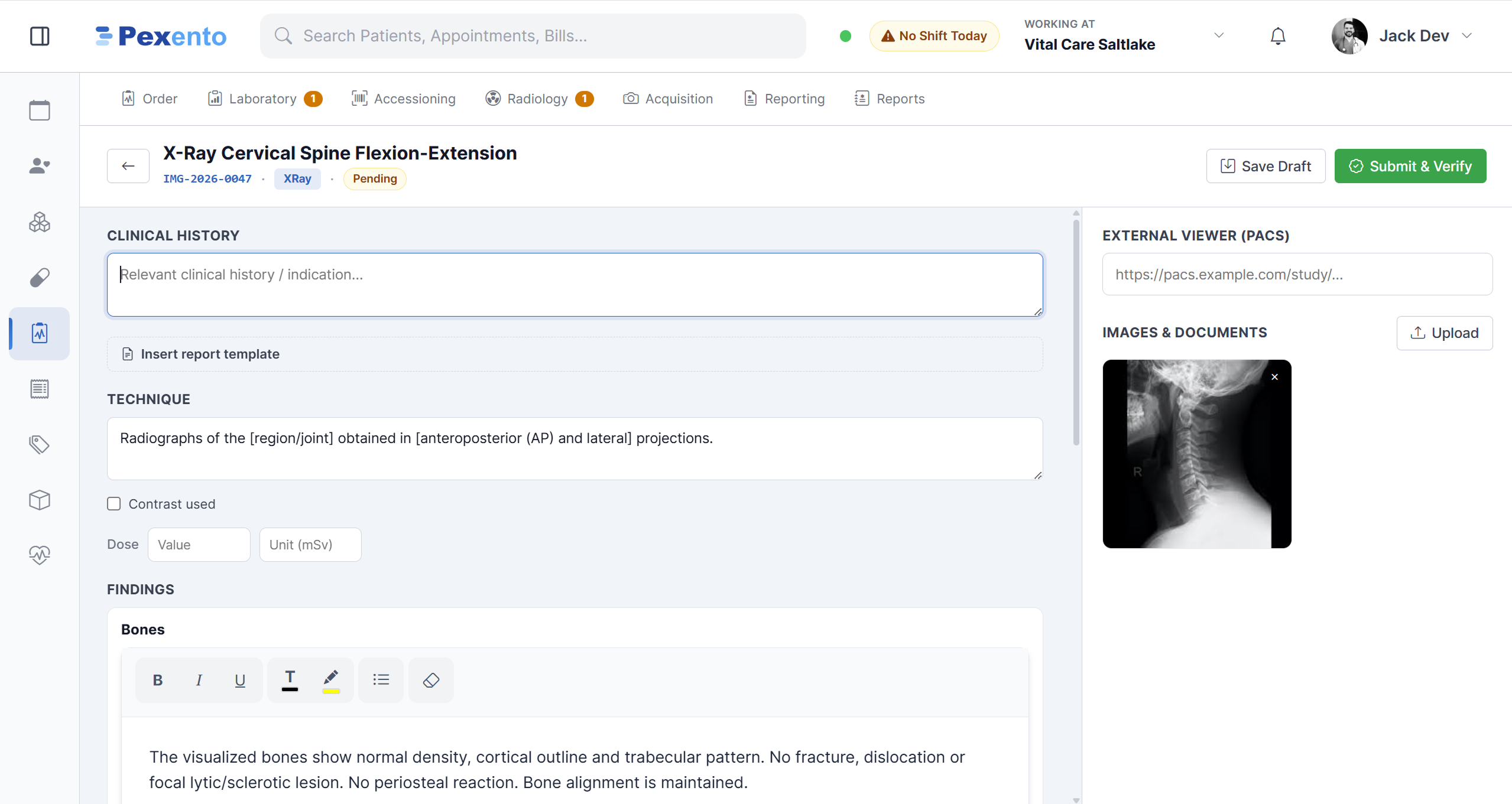 Radiology reporting screen with clinical history, technique, findings and an attached image